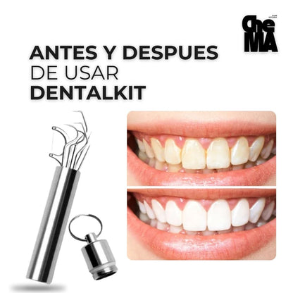 DENTALKIT  Limpieza Dental Palillo De Acero